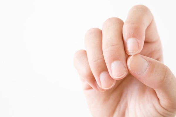 What Your Fingernails Say about Your Health
