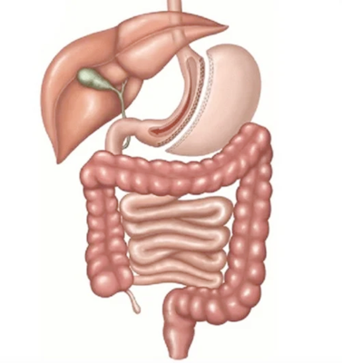 Sleeve Gastrectomy Illustration